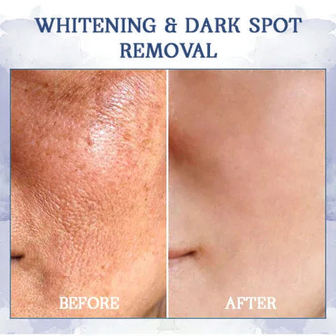 𝐋𝐚𝐬𝐭 𝐃𝐚𝐲 𝐃𝐢𝐬𝐜𝐨𝐮𝐧𝐭: 85% 𝐎𝐅𝐅 - 𝐅𝐮𝐛𝐬𝐭𝐚® Advanced Fat-Burning & Firming Cream: Eliminate Excess Fat and Restore Skin Elasticity