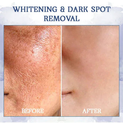 𝐋𝐚𝐬𝐭 𝐃𝐚𝐲 𝐃𝐢𝐬𝐜𝐨𝐮𝐧𝐭: 85% 𝐎𝐅𝐅 - 𝐅𝐮𝐛𝐬𝐭𝐚® Advanced Fat-Burning & Firming Cream: Eliminate Excess Fat and Restore Skin Elasticity