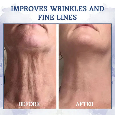 𝐋𝐚𝐬𝐭 𝐃𝐚𝐲 𝐃𝐢𝐬𝐜𝐨𝐮𝐧𝐭: 85% 𝐎𝐅𝐅 - 𝐅𝐮𝐛𝐬𝐭𝐚® Advanced Fat-Burning & Firming Cream: Eliminate Excess Fat and Restore Skin Elasticity